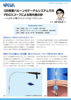 PEGnews2 表面n