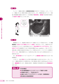 サンプル