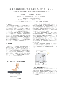 脳卒中片麻痺に対する新規歩行リハビリテーション