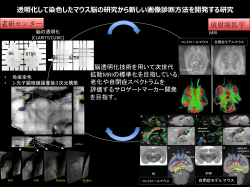 透明化して染色したマウス脳の研究から新しい画像診断方法を開発する