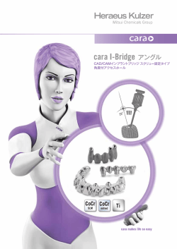 cara I-Bridge アングル