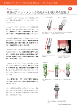 角度付アバットメントの傾斜方向と埋入時の留意点