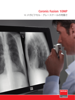 Coronis Fusion 10MP 10メガピクセル・グレースケールの完璧さ