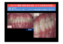 ラビアル（唇側・表側）矯正治療 2)-⑦ 反対咬合の改善