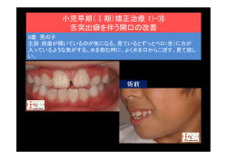小児早期（Ⅰ期）矯正治療 1)-⑩ 舌突出癖を伴う開口の改善