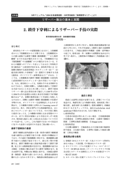 リザーバー動注の基本と実際