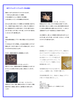 家ダニアレルギーにアレルギーがある場合 お掃除 掃除機はダストを
