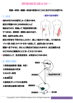 尿路結石症とは&hellip;