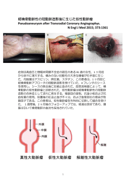 経橈骨動脈性の冠動脈造影後の仮性動脈瘤（※PDF）