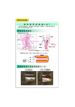 頸部超音波検査