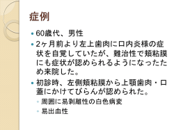 解説6 - PlaceHolder for csj