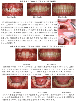 参考症例pdf