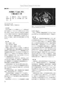 内視鏡にて止血し得た 小腸出血の1例