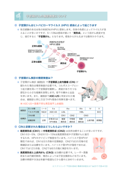 子宮頸がんの精密検査について