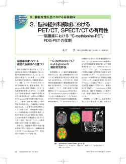 3． 脳神経外科領域における PET/CT，SPECT/CTの有用性