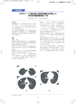 一般演題6 SPECT‐CT融合像で肺局所機能を評価した 多発性肺動静脈