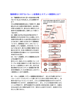 動脈硬化に対するバルーン拡張術とステント留置術とは？