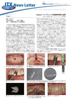 ITX News Letter