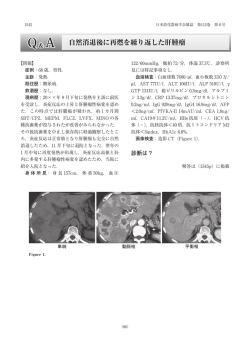 自然消退後に再燃を繰り返した肝腫瘤