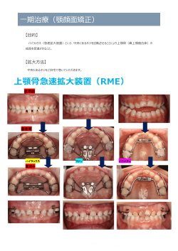 3.一期治療(RME：顎顔面矯正)
