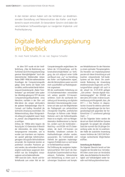 Digitale Behandlungsplanung im &Uuml;berblick