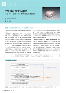 不思議な矯正治療法