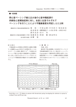 両心室ペーシング植え込み後の心室中隔起源の 持続性心室頻拍症例に