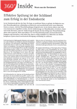Effektive Spülung ist der Schlüssel zum Erfolg in der Endodontie