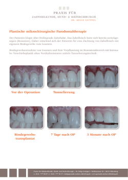 Plastische mikrochirurgische Parodontaltherapie Vor der Operation