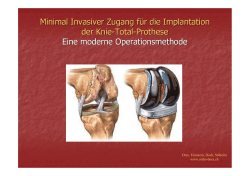 Minimal Invasiver Zugang für die Implantation der Knie