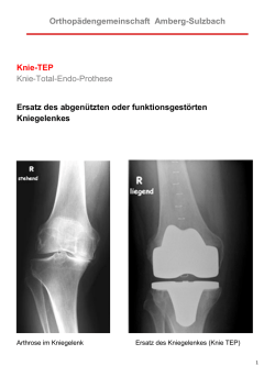 Orthopädengemeinschaft Amberg-Sulzbach Knie-TEP Knie