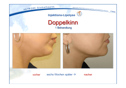 Injektions-Lipolyse