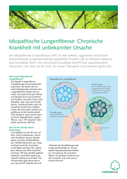 Idiopathische Lungenfibrose: Chronische Krankheit mit unbekannter
