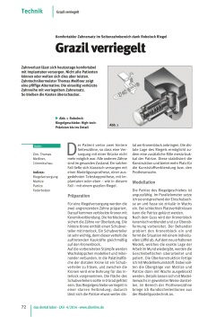 Grazil verriegelt - crimmitschauer dentallabor gmbh