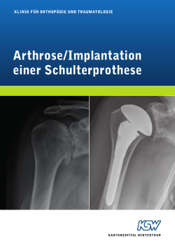 Arthrose/Implantation einer Schulterprothese