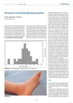 Chronisch nicht-bakterielle Osteomyelitis