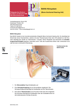 BAHA (Bone Anchored Hearing Aid