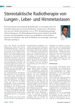 Stereotaktische Radiotherapie von Lungen-, Leber
