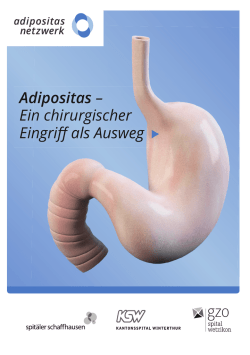 Adipositas – Ein chirurgischer Eingriff als Ausweg