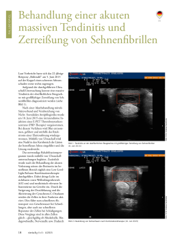 Behandlung einer akuten massiven Tendinitis und Zerreißung von