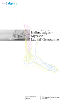 Hallux valgus – Myerson / Ludloff-Osteotomie