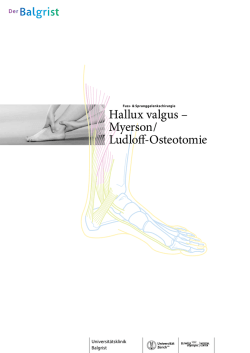 Hallux valgus &ndash; Myerson / Ludloff-Osteotomie