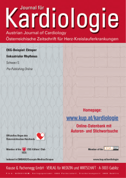 EKG-Beispiel: Ektoper linksatrialer Rhythmus