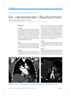 Ein «zerreissender» Bauchschmerz