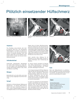 Plötzlich einsetzender Hüftschmerz