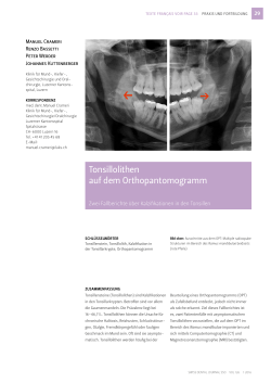 Tonsillolithen auf dem Orthopantomogramm