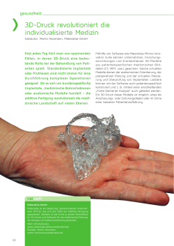 3D-Druck revolutioniert die individualisierte Medizin