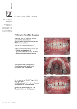 Korrektur eines Kreuzbisses - Praxis Dr. med. dent. Steiger