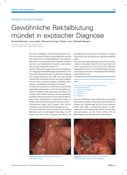 Gewöhnliche Rektalblutung mündet in exotischer Diagnose