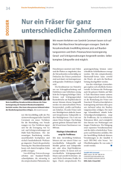 Nur ein Fräser für ganz unterschiedliche Zahnformen
